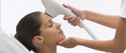IPL Intense Pulsed Light
