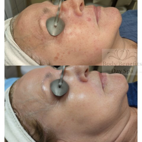 Before-and-after-IPL