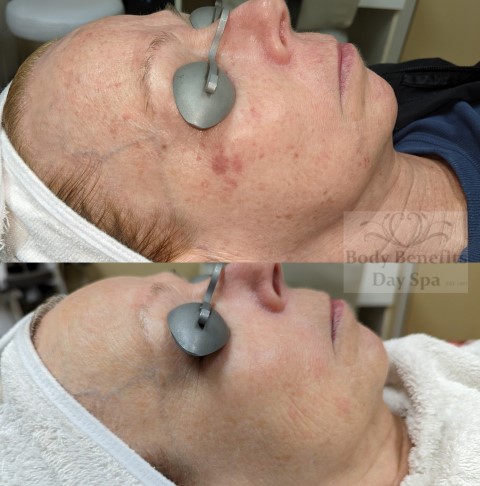 Before-and-after-IPL